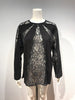 RADIATION LACE LS TOPS